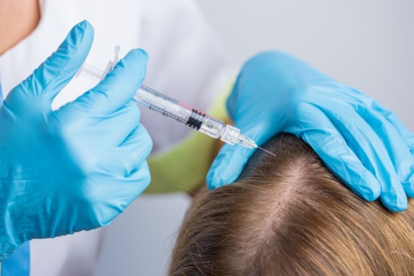 Hair Restoration